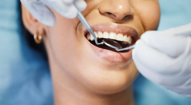 Best Emergency Denture Repair in Lake Mohawk, NJ